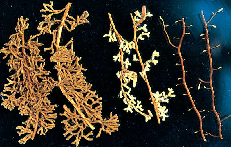 mycorrhizal relationship