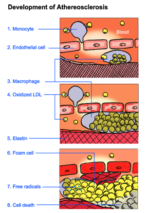 development of athereosclerosis