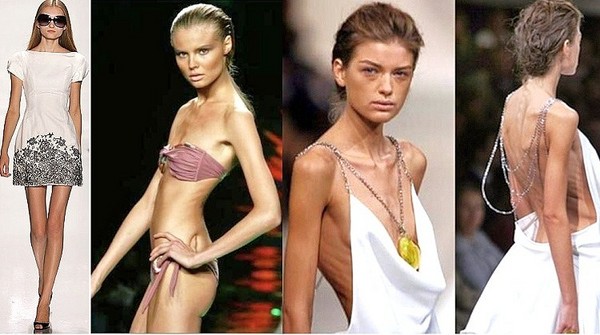 anorexic model
