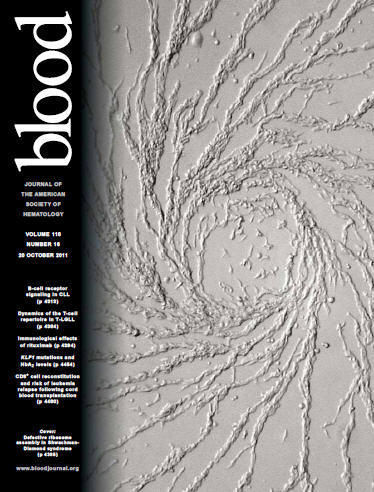 SDS cell on cover of Blood Journal